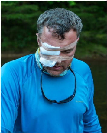 Jim Klug recuerda su evacuación de la selva boliviana tras una extraña lesión ocular